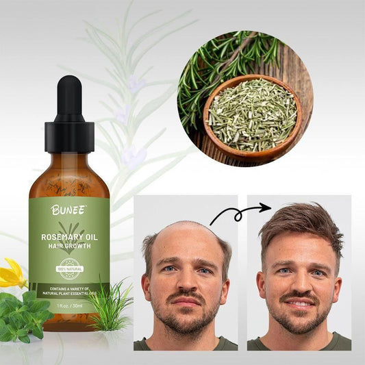 GrowGleam™️ Rosemary Hair Growth Serum Oil (Pack of 2)